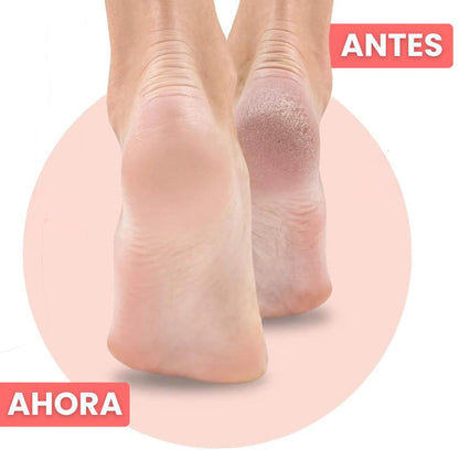 Quita callos recargable